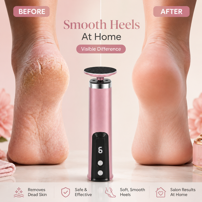 SoftAura™ PediSmooth Pro – Electric Foot Callus Remover