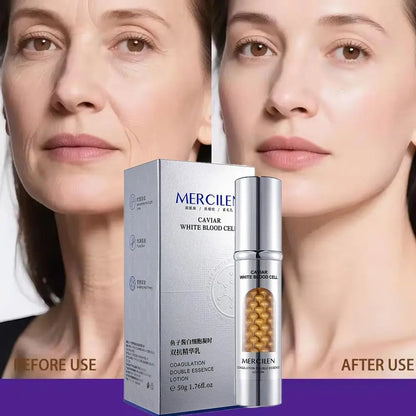 1/2CS Mercilen Facial Moisturizing Serum Oil Control Skin Face Cream For Sagging Skin Fine Lines Elasticity Korean Skin Care