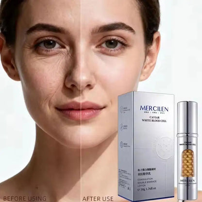 1/2CS Mercilen Facial Moisturizing Serum Oil Control Skin Face Cream For Sagging Skin Fine Lines Elasticity Korean Skin Care